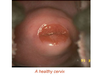 healthy cervix